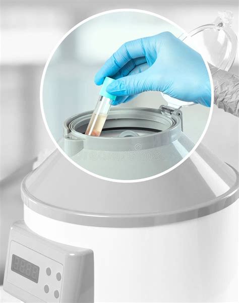 prp centrifuge|prp centrifuge method.